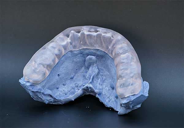 Guarda oclusal dental