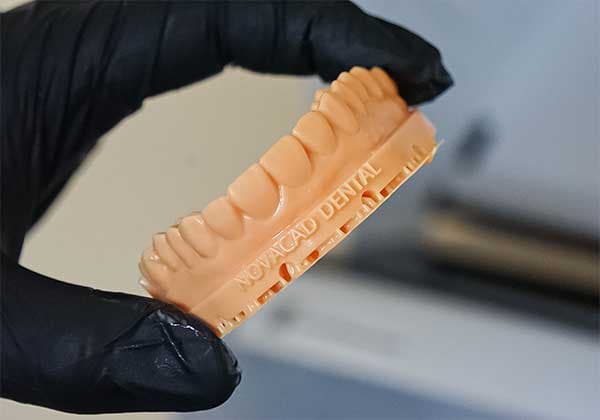 Mock up para tratamiento dental estético